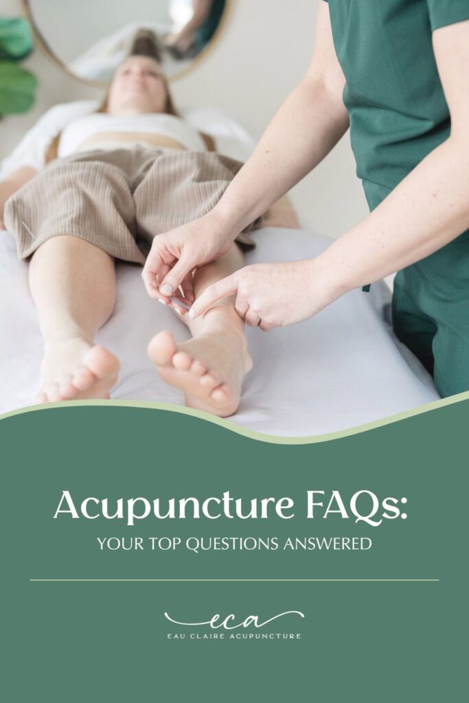 Woman receiving acupuncture on her foot and the words "Acupuncture FAQ's: Your top questions answered"
