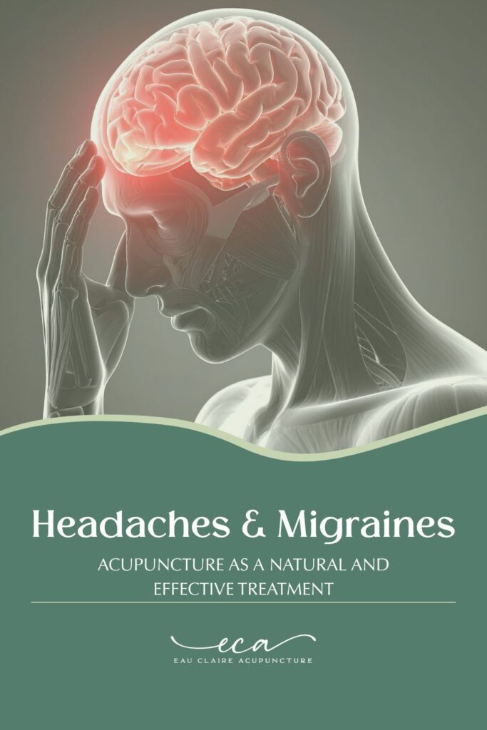 Illustration highlighting areas of pain in the head associated with tension headaches.