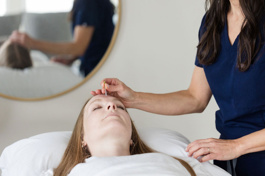 Vallie, a licensed acupuncturist, needling the point Yin Tang between the eyebrows to help treat anxiety and stress.