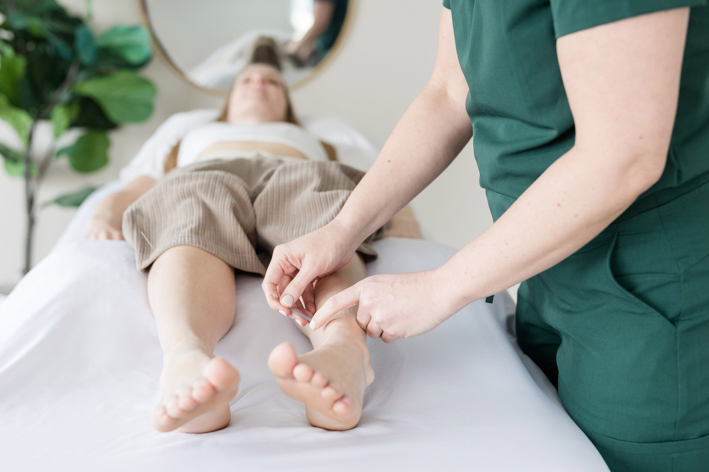 Woman receiving acupuncture on her foot